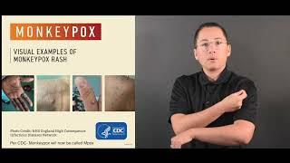 About Mpox ASL Video