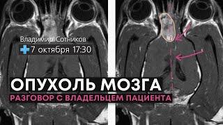 Опухоль мозга - разговор с владельцем пациента