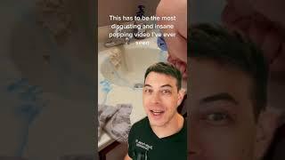 Derm Reacts to Insane Cyst Pop  208SkinDoc Dr. Dustin Portela #shorts