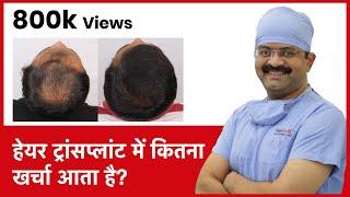 What Is The Cost Of Hair Transplant In India हेयर ट्रांसप्लांट में कितना खर्चा आता है  In HINDI