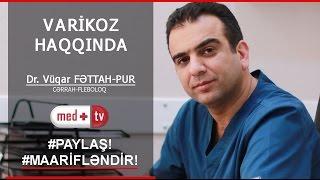 VARIKOZ XESTELIYI HAQQINDA BILMEDIKLERIMIZ- Dr. Vuqar FETTAH-PUR Cerrah-Fleboloq MEDPLUS