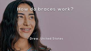 How do braces work?