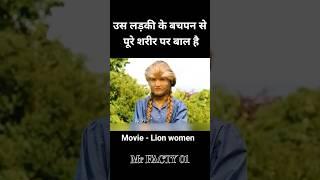 इस लड़की के बचपन से पूरे शरीर पर बॉल थे  #shortsvideo #ytshorts