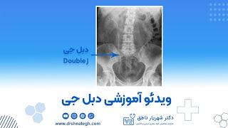 ویدئو آموزشی دبل جی Double J