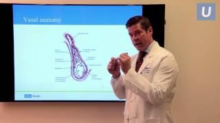 Vasectomy Reversal Fertility Options After Vasectomy  Jesse Mills MD  UCLAMDChat