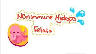 Nonimmune hydrops fetalis