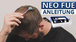 NEO FUE Anleitung Anwendung & Vorteile