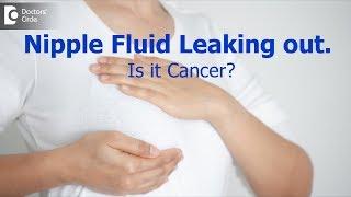 Fluid leaking from the nipples. Is it a sign of breast cancer? - Dr. Nanda Rajneesh Doctors Circle