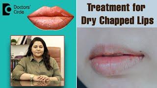 Heal Chapped Lips Fast with these 4 Simple Remedies  - Dr. Tina Ramachander  Doctors Circle