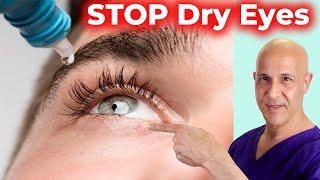 Soothe and Heal DRY EYES Naturally  Dr. Mandell