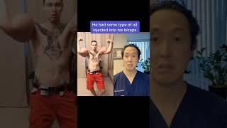 Doctor Reacts to Massive FAKE Biceps #shorts #synthol
