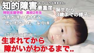 【知的障害・最重度】生まれてから障がいがわかるまで..誕生から3歳までの様子。成長が遅いだけだと思いたかった、あの頃..特別支援学校　高校2年生おしゃべりできません。