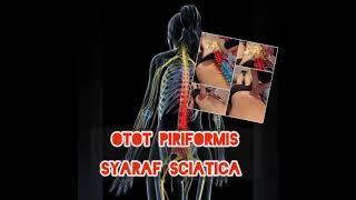 Shorts burnout otot Piriformis #hot #pain #viral #sciatica #nerves #assessment #massage #training