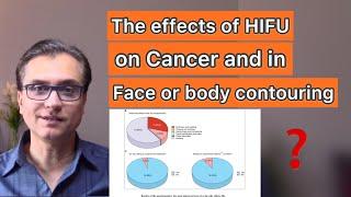 What Are The Effects Of HIFU In Cancer And Aesthetic Medicine?