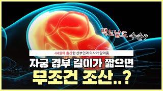 자궁 경부 길이가 중요한 이유는?｜자궁경관무력증의 치료 방법은?｜원장님이 임신부에게 전하는 이야기 - 노노산부인과 ep54