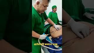 পেটের চর্বি কমানোর উপায়  Lower belly Fat Removing  Liposuction ️01639139232 What’s App & imo