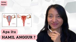 APA ITU HAMIL ANGGUR ? -Bubid Dian.M.Phil-