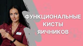 Функциональные кисты яичников