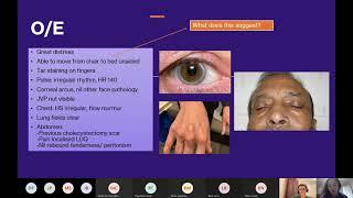 Y4 Ischaemic Bowel and Atrial Fibrillation