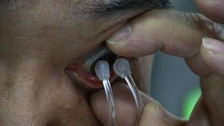 Inserting and Removing Soft Contact Lenses without Touching the Fingers #Diginfo