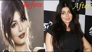 Top Bollywood Actress Went Through Plastic Surgery  Shocking Transformation