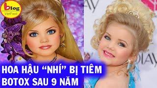 Hoa hậu nhí nước Mỹ bị chín ép một thời Sau 9 năm gây bất ngờ