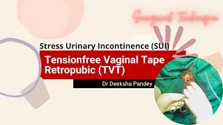 Tensionfree vaginal tape - Retropubic  TVT - Retropubic  Mid urethral sling MUS  TVT for SUI