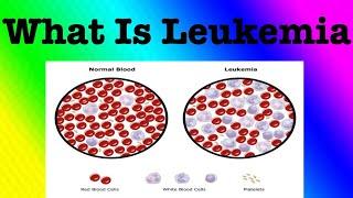 What is Leukemia ?