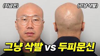 그냥 삭발 vs 두피문신 전격 비교