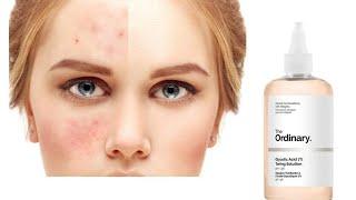 شرح مبسط ذا اورديناري تونر البشرة بحمض الجليكوليك اسيد Glycolic Acid 7