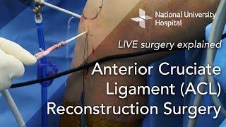 LIVE Surgery Explained Anterior Cruciate Ligament ACL Reconstruction Surgery