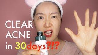 SOME BY MI AHA BHA PHA 30 Days Miracle Toner Review  5 Min Review with Euni