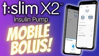 Tslim X2 Mobile Bolus FDA Approved The Good & BAD News...
