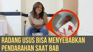 Radang Usus Bisa Menyebabkan Pendarahan Saat BAB