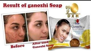 Dxn ganozhi soapbenifits of dxn ganozhi soap#shorts#dxn soapRemove pimples