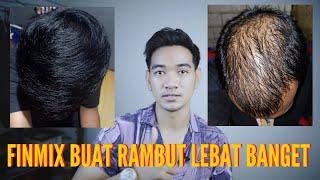 Pakai finmix perubahan rambutnya luar biasa #pejuangganteng