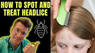 How to spot and treat Head lice nits  Doctor ODonovan explains...