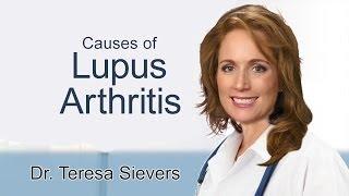 Causes of Lupus Arthritis  Dr. Sievers discusses what causes lupus arthritis
