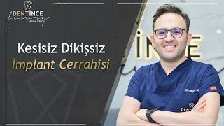 Kesisiz Dikişsiz İmplant CerrahisiDentince #implant