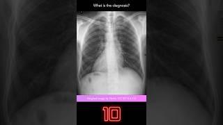Chest X-ray Quiz 10 explanation with overlays