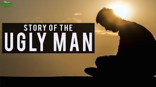 The story of the ugly man