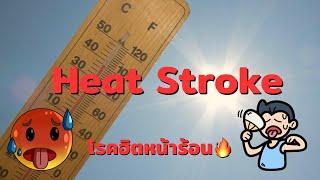 Heat Stroke - โรคฮิตหน้าร้อน