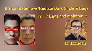 8 Tips to ReduceRemove dark circles and puffiness fast What are Dos and Don’ts?