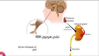 ماهو الفرق بين السكر الحقيقي  dm والسكر الكاذب di؟؟