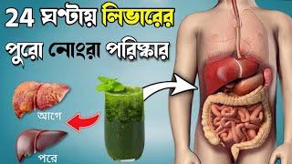 লিভারের সব নোংরা এক বারেই পরিষ্কার করুন  How To Detox Your Liver  Bangla