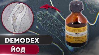 Iodine against tick  Demodex folliculorum