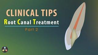 Root Canal Treatment  Clinical tips  Part 2