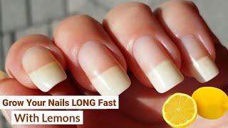 How To Grow Your Nails LONG Fast With Lemons Home remedies for nail growth  nails grow faster 