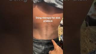 How to use sting therapy #stingtherapy #treatment #beestingtherapy