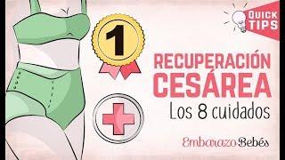 #CESÁREA  Logra una recuperación rápida ⏰ 8 CUIDADOS